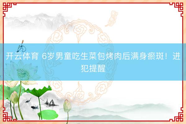 开云体育 6岁男童吃生菜包烤肉后满身瘀斑！进犯提醒